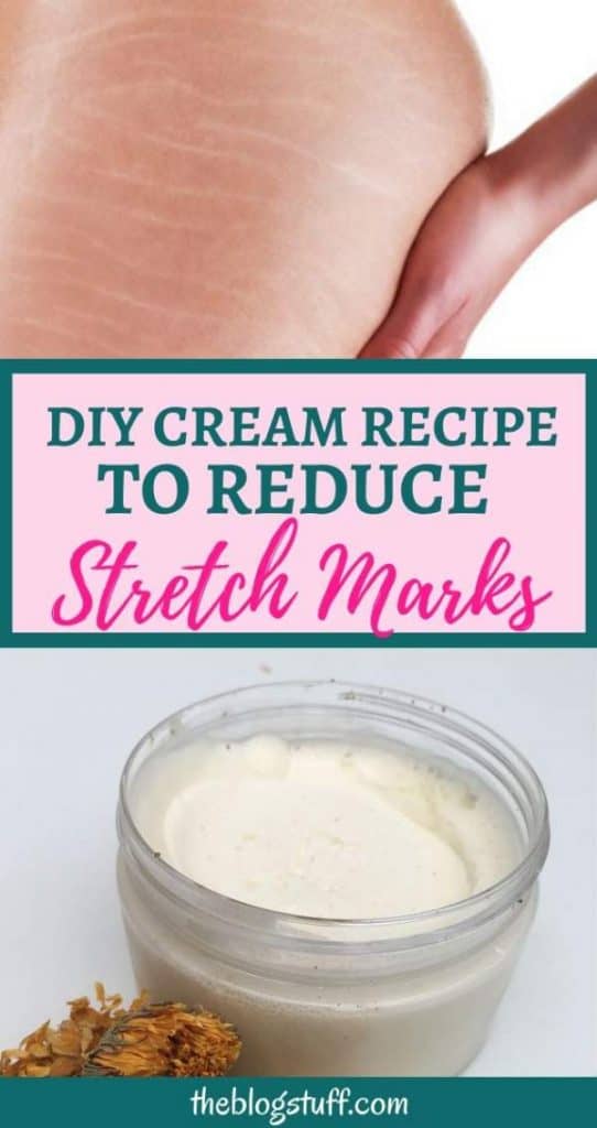 DIY cream recipe to reduce stretch marks naturally